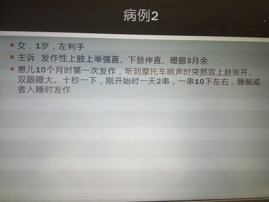 婴儿痉挛千万别大意，记住6个特点，及时治疗才能减少后遗症