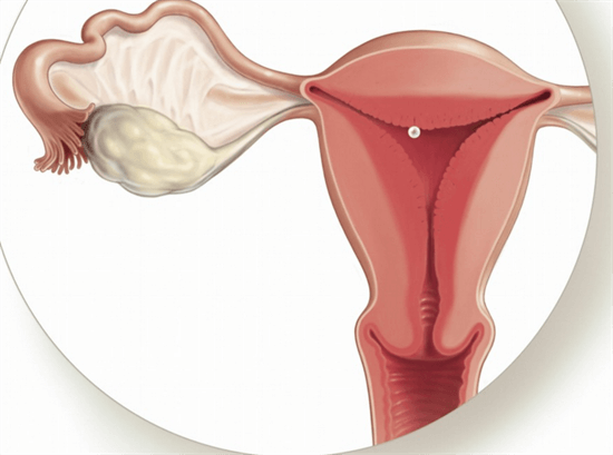 医生：女性月经结束后，4种异常频繁出现，赶紧检查HPV