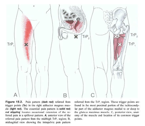 女性大腿根部内侧疼痛图片