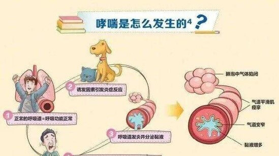 世界哮喘日是哪一天 世界哮喘日什么时候开始