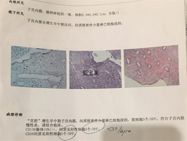 做什么检查才能知道宫腔是否粘连？