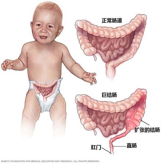 应对宝宝便秘有这些套路你就赢了一半，妈妈们必知，遇到不慌张