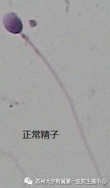 长得帅的男人精子质量不一定高 2014-09-12